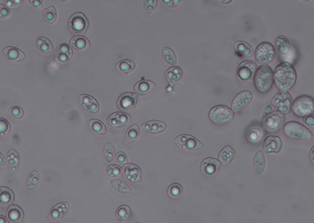 Microscopic Image of a Yeast Sample