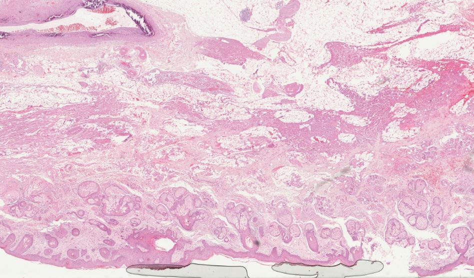 histology slide with air inclusions at the bottom edge