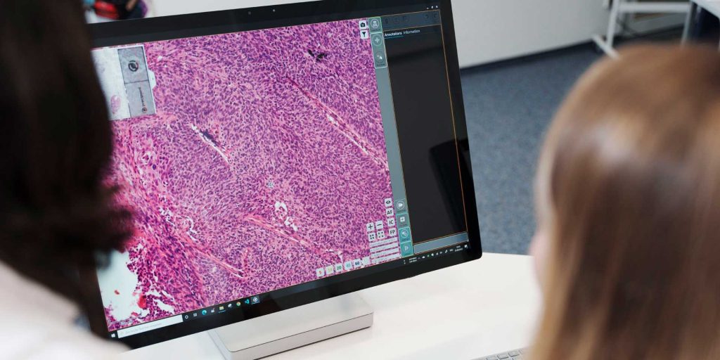 Analyzing high-precision images produced by digital pathology