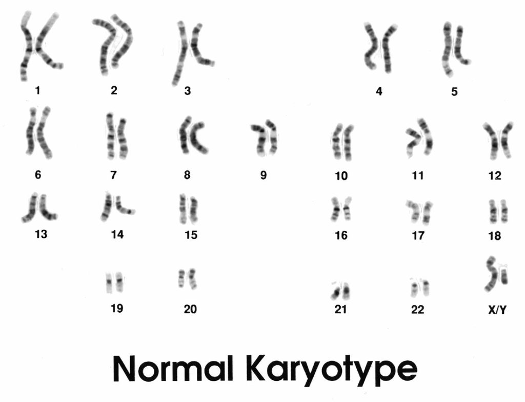 A normal male karyotype