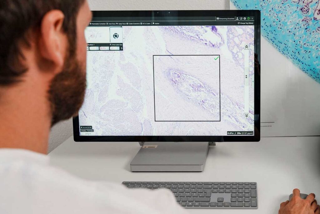 Accessing second opinion with real-time digital microscopy