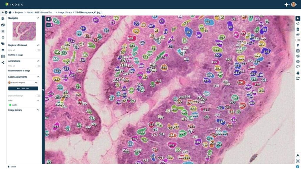 Use of artificial intelligence in digital pathology