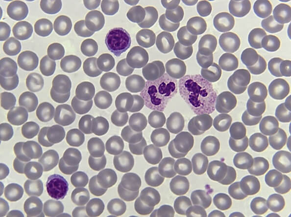 Microscopic morphology of blood cells