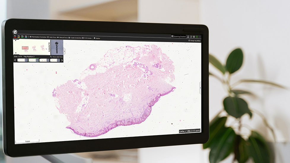 How Does Digital Pathology Contribute to Whole Slide Imaging?